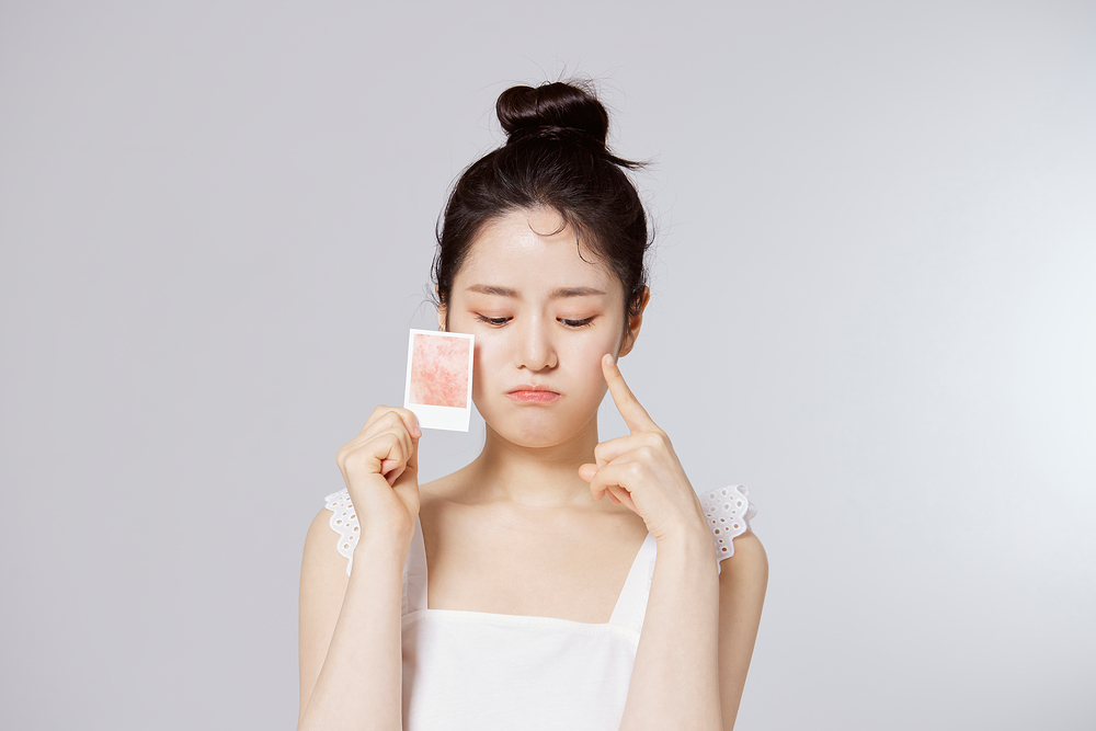 凱麗雅皮膚科療程效果展示