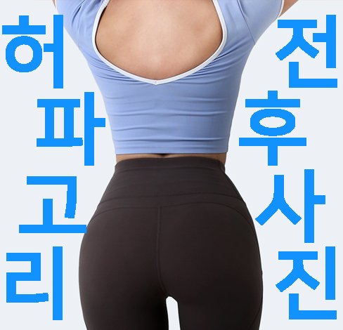 365mc 슬림에디션 수술 장비