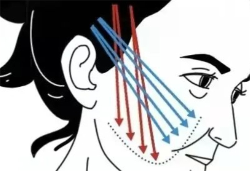 디엠 수술 후 관리