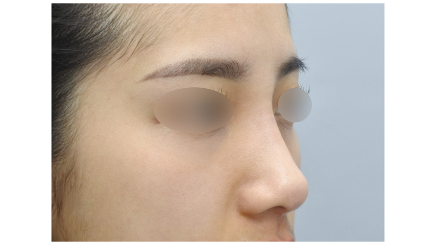 韓國釜山丽諾博Renovo皮膚科怎麼樣：西面核心商圈12年老牌，抗衰注射真實體驗全攻略缩略图